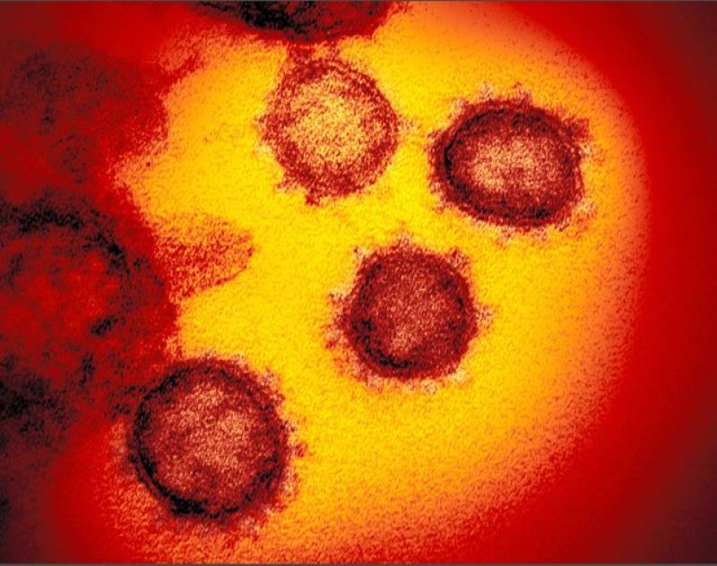 Virus Corona chủng mới tồn tại trên da người đến 9 giờ đồng hồ